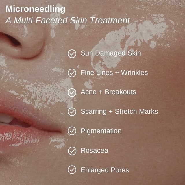 Jeju Radiance Series: 6 Sessions at Wild Sage Aesthetics in Boulder, CO